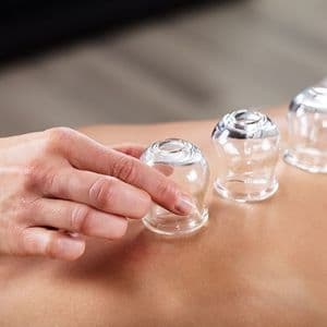 Formation en technique des ventouses